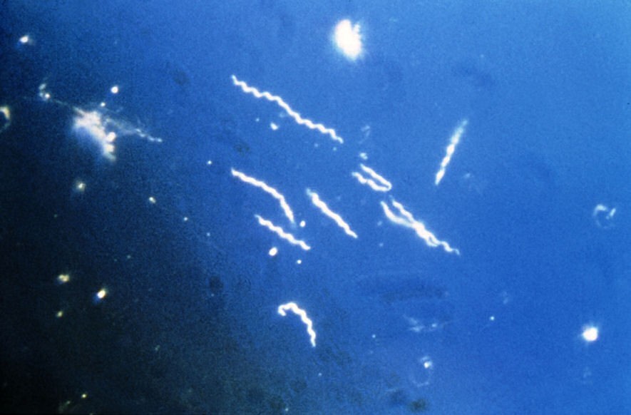 borrelia